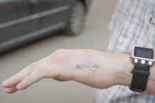 Житель России вживил себе в руку чип от транспортной карты