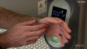 Австралиец вживил себе под кожу проездной – фото