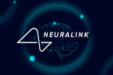 Neuralink впервые вживила имплант в человеческий мозг — Маск