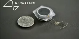 Чип Neuralink вживят в мозг еще одному человеку — Илон Маск
